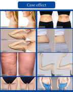 Onda Body Slimming