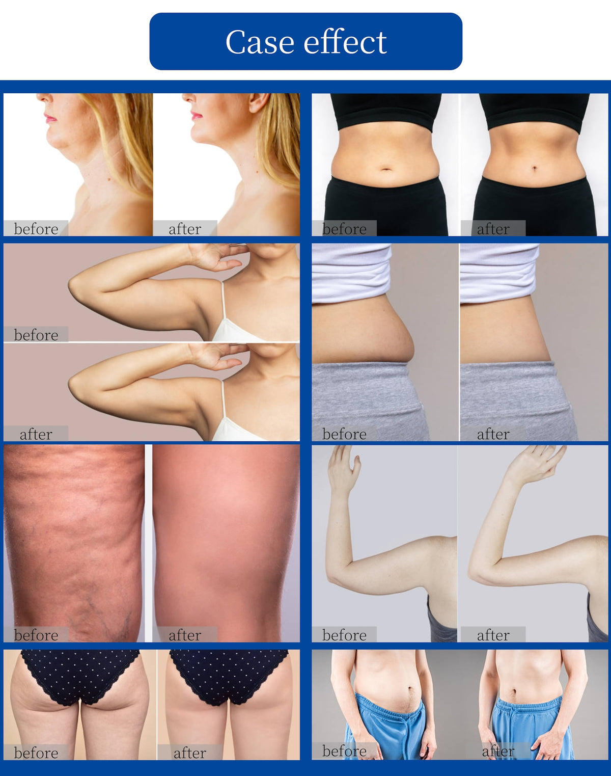 Onda Body Slimming