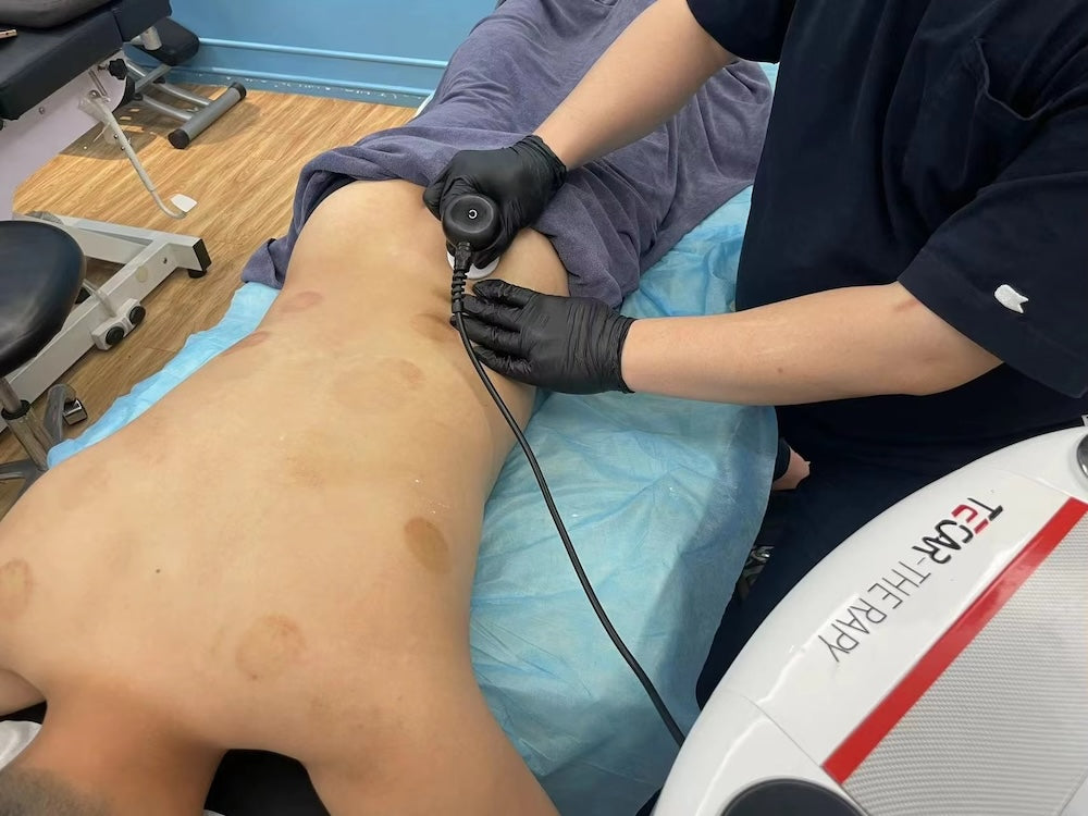 Muscle Pain Relief Tissue Physiotherapy Tecar Cet Ret 448khz Cellulite Removal Slimming Machine