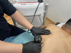 Muscle Pain Relief Tissue Physiotherapy Tecar Cet Ret 448khz Cellulite Removal Slimming Machine